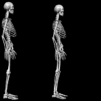 skeletons